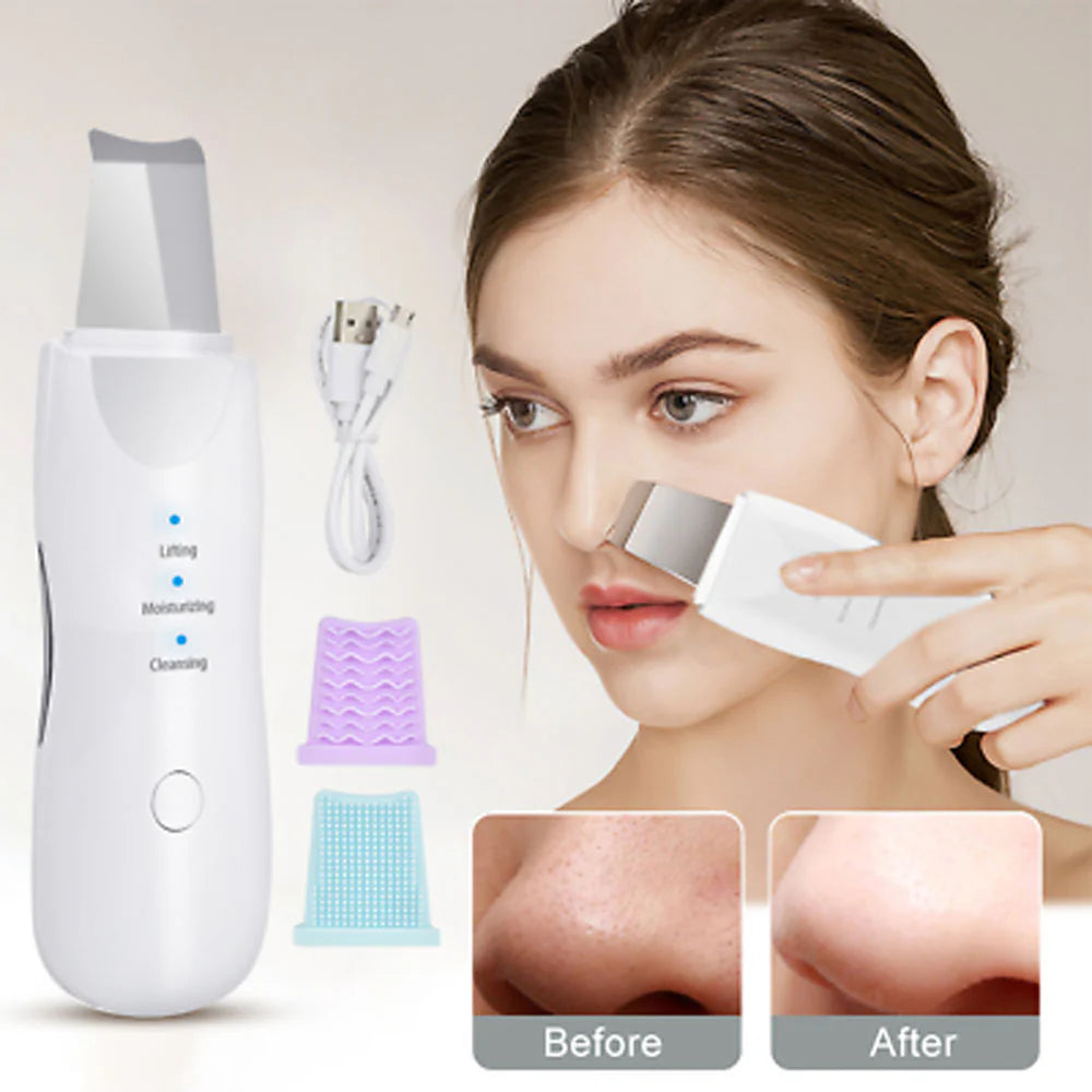 Máquina exfoliante facial con pala, espátula exfoliante ultrasónica