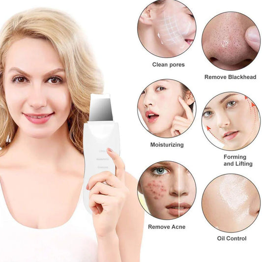 Máquina exfoliante facial con pala, espátula exfoliante ultrasónica