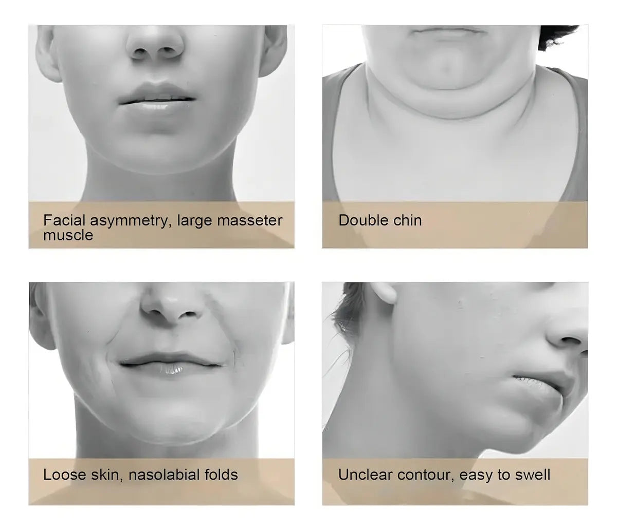 V-FaceGo: Define tu rostro, eleva tu belleza. El original. El reductor de papada inteligente 100% original. Terapia LED, microcorrientes EMS y control remoto para un perfil perfecto.