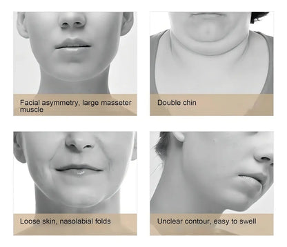 V-FaceGo: Define tu rostro, eleva tu belleza. El original. El reductor de papada inteligente 100% original. Terapia LED, microcorrientes EMS y control remoto para un perfil perfecto.