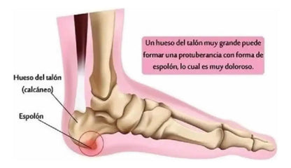 BlueStep Alivio Tota: La Original : Menos impacto, más bienestar en tu día a día
